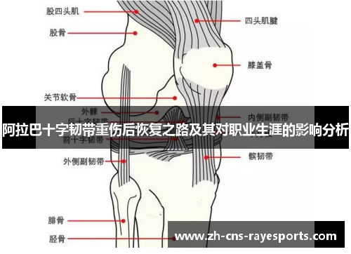 阿拉巴十字韧带重伤后恢复之路及其对职业生涯的影响分析
